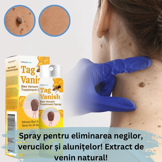 Spray pentru Eliminarea Negilor, Verucilor și Alunițelor cu Extract de Venin Natural